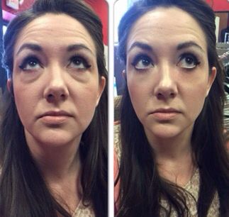 INSTANTLY AGELESS™ (5 UNIDADES)