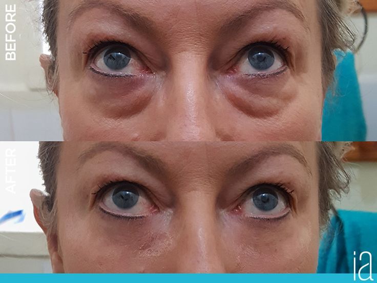 INSTANTLY AGELESS™ (5 UNIDADES)